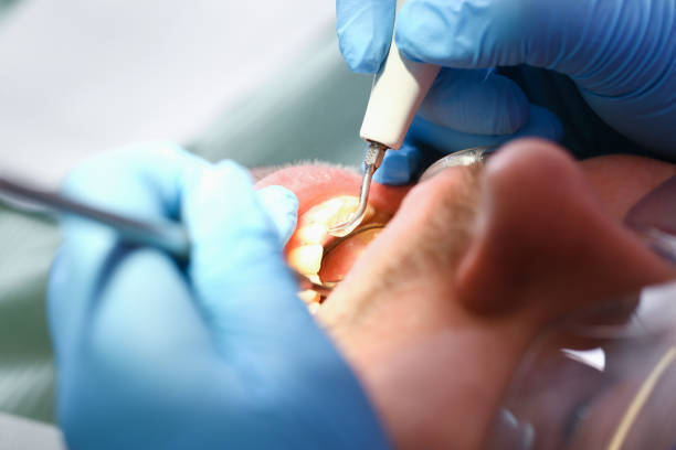 Best Cracked Tooth Emergency Dentist  in Denton, MD
